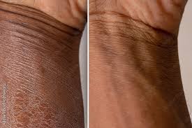 SKIN CARE ROUTINE ORDER MORNING AND NIGHT FOR SKIN TYPE